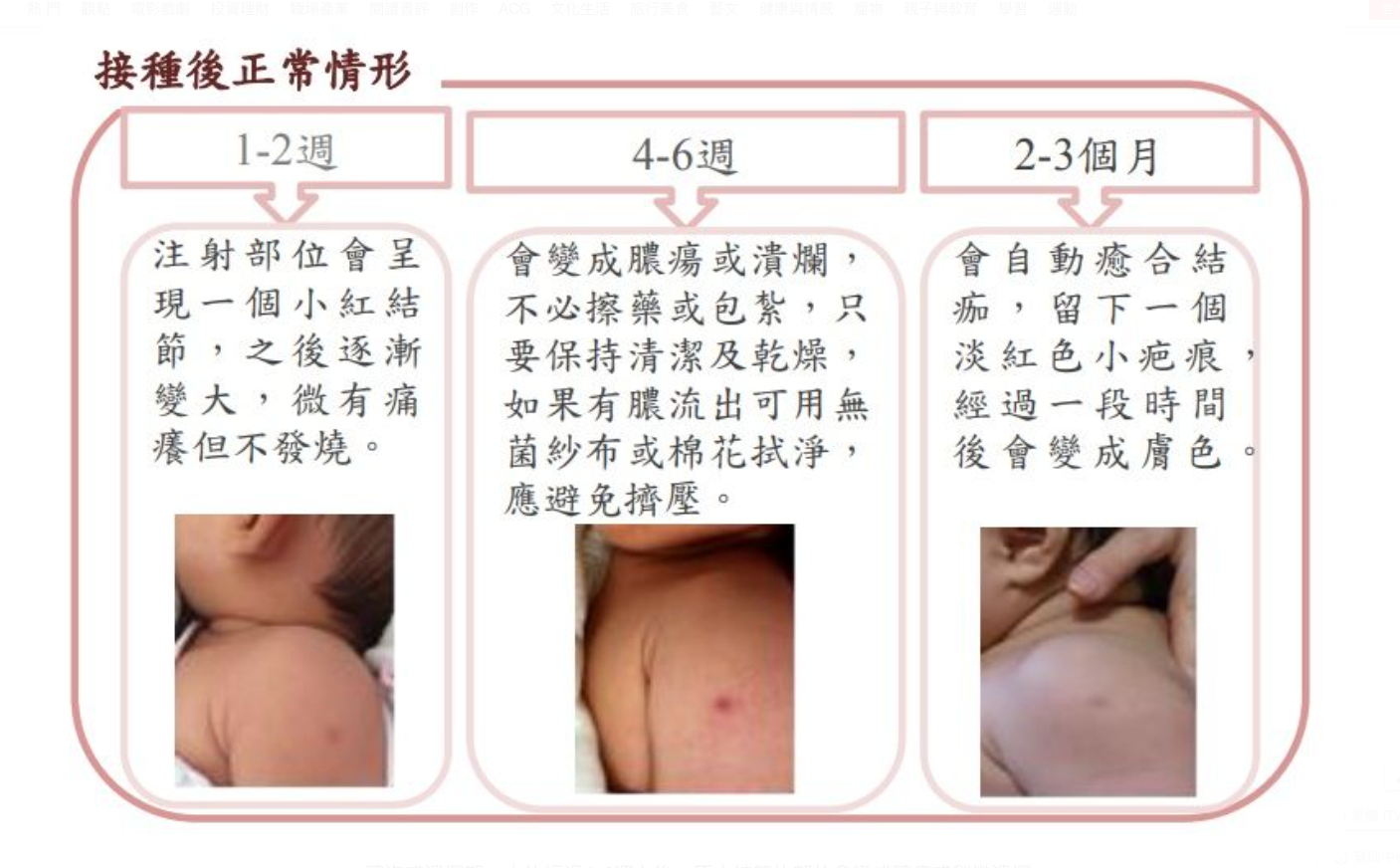 傳說中的魔王針：卡介苗的副作用與處理